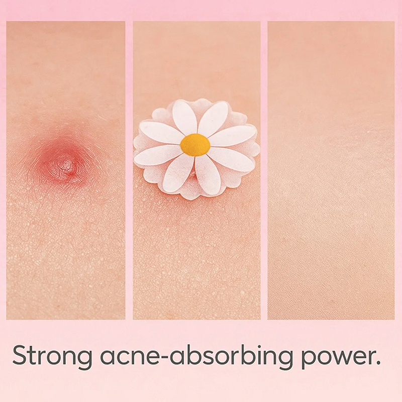 100 Parches Invisibles para el - Skincare China reseña y precio