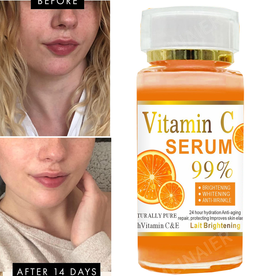 Suero de vitamina C súper 120m - Vitamin C Serum reseña y precio